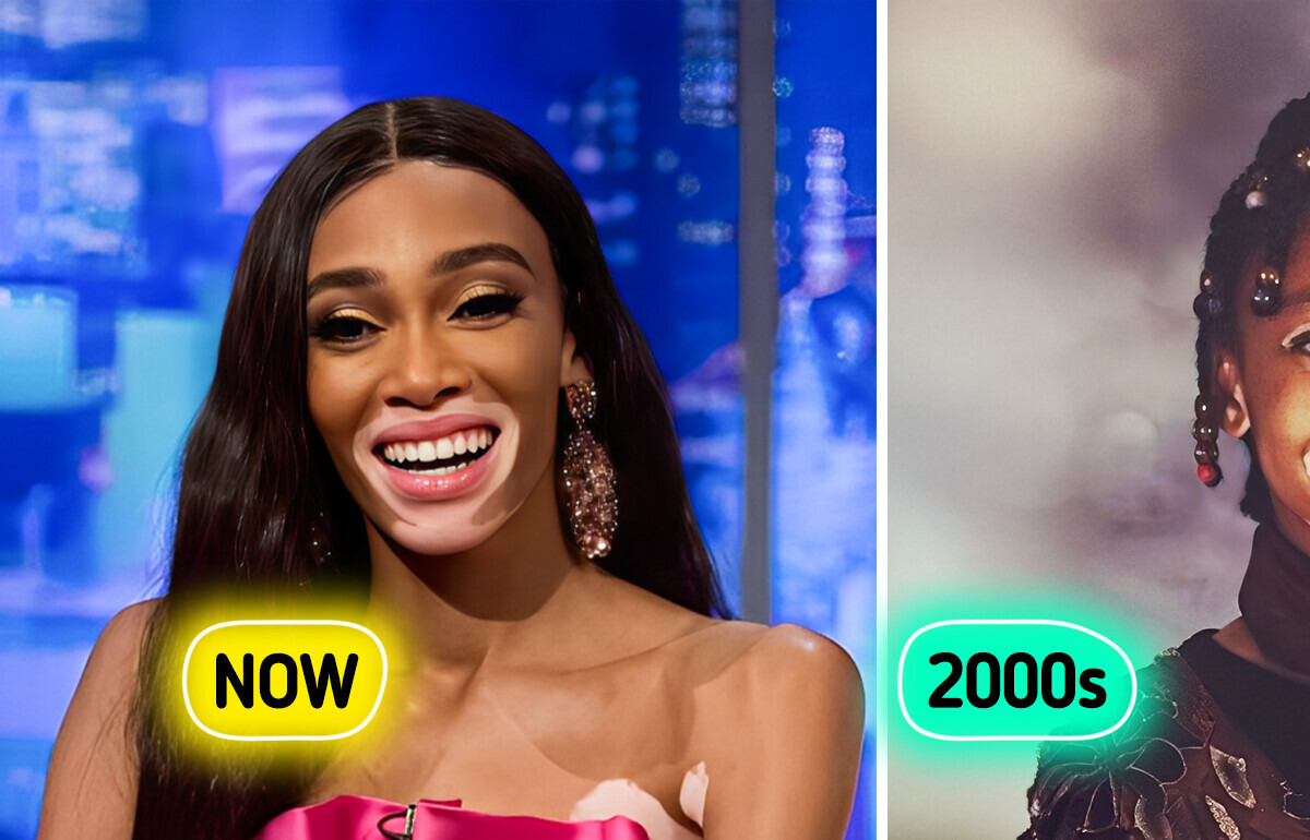 Meet Winnie Harlow, the Vitiligo Supermodel Breaking Beauty Rules Since Childhood