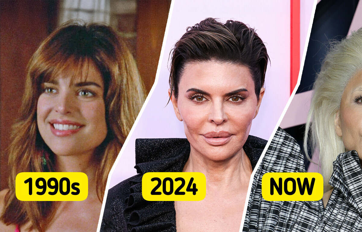 “Her Lips Are Bigger Than Ever”, Lisa Rinna’s Latest Appearance Sparks Controversy