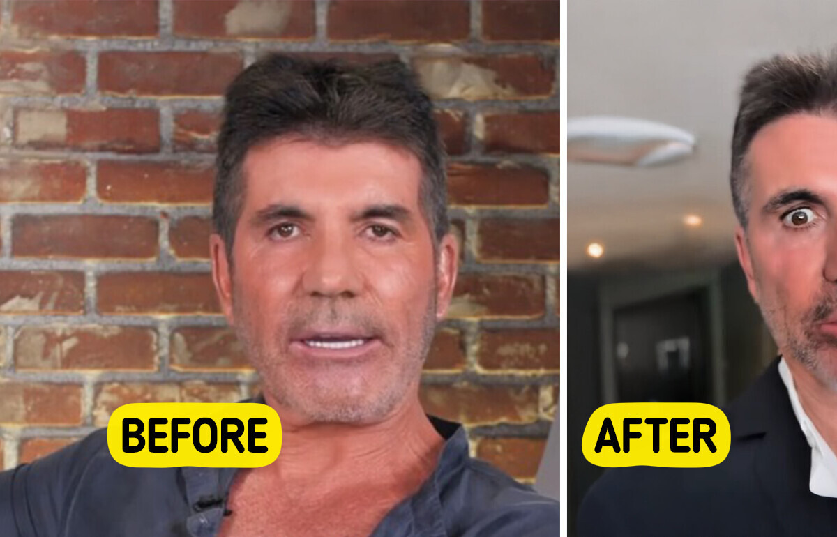 “What a Shame!” Simon Cowell’s Shocking Transformation Leaves Viewers Speechless