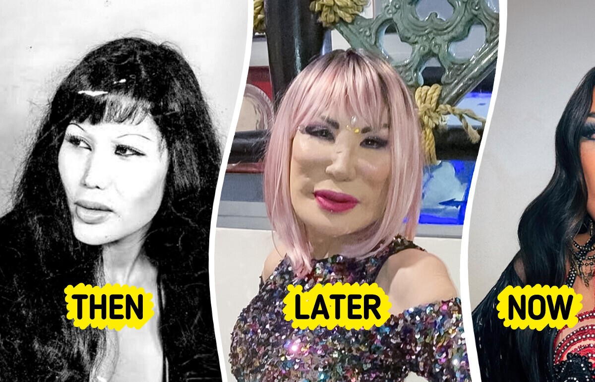 Jealousy Pushed This Mexican Star Into a Beauty Disaster — See Her Inspiring Journey of Recovery Jealousy Pushed This Mexican Star Into a Beauty Disaster — See Her Inspiring Journey of Recovery