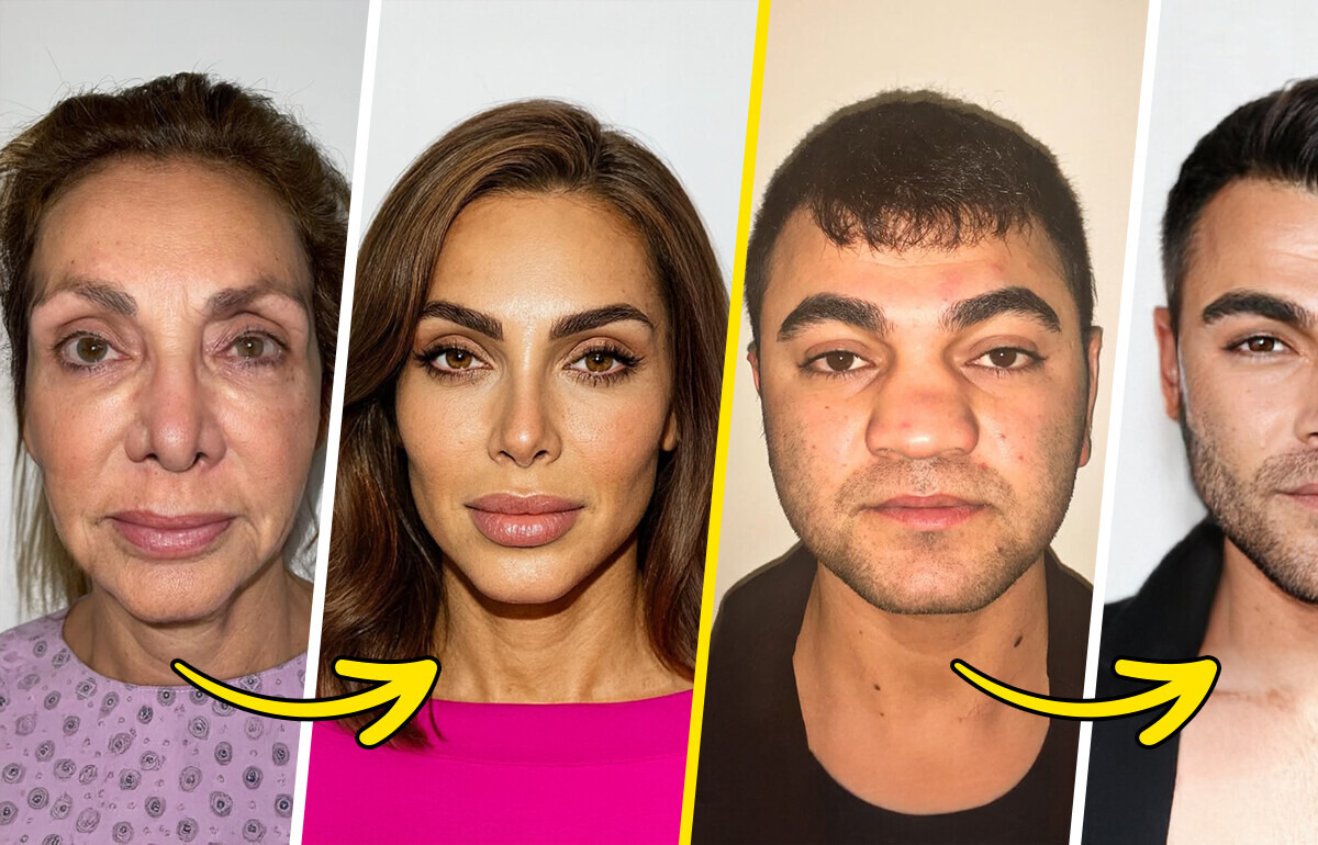 Plastic Surgery With a Mysterious Formula — The Results Are Shocking Plastic Surgery With a Mysterious Formula — The Results Are Shocking