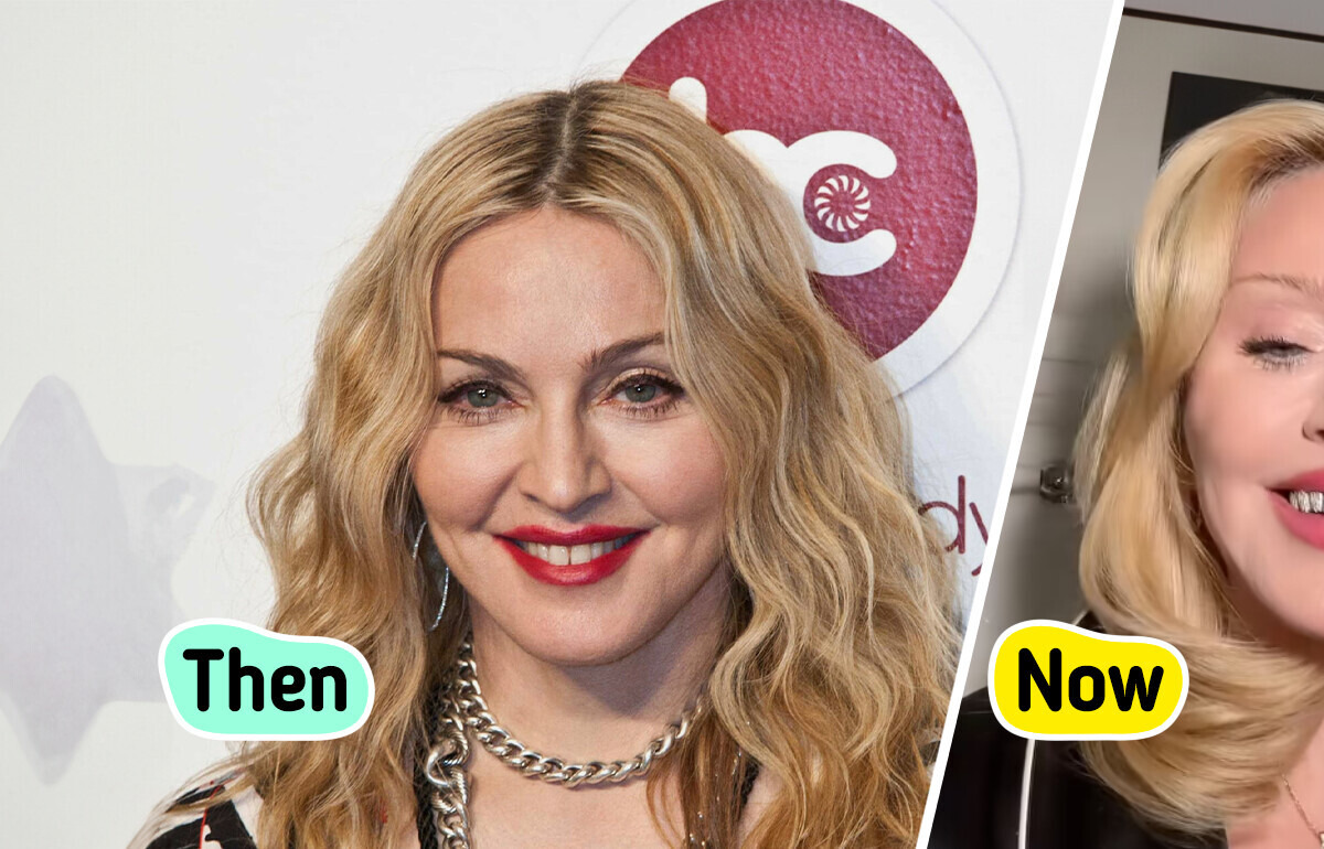 Madonna Shows Off Her New Teeth, But People Are Focusing on Something Else Madonna Shows Off Her New Teeth, But People Are Focusing on Something Else
