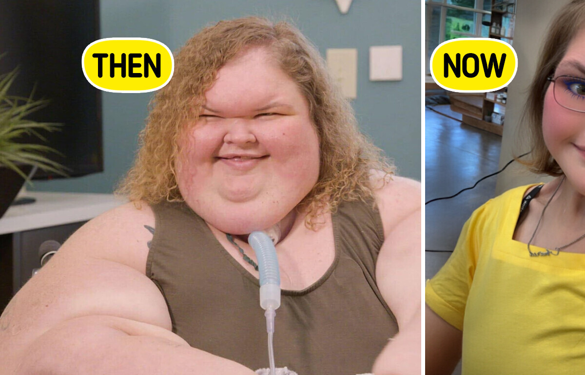 “1,000-lb Sisters” Star Reveals Remarkable 400-Pound Weight Loss and Skin Surgery “1,000-lb Sisters” Star Reveals Remarkable 400-Pound Weight Loss and Skin Surgery