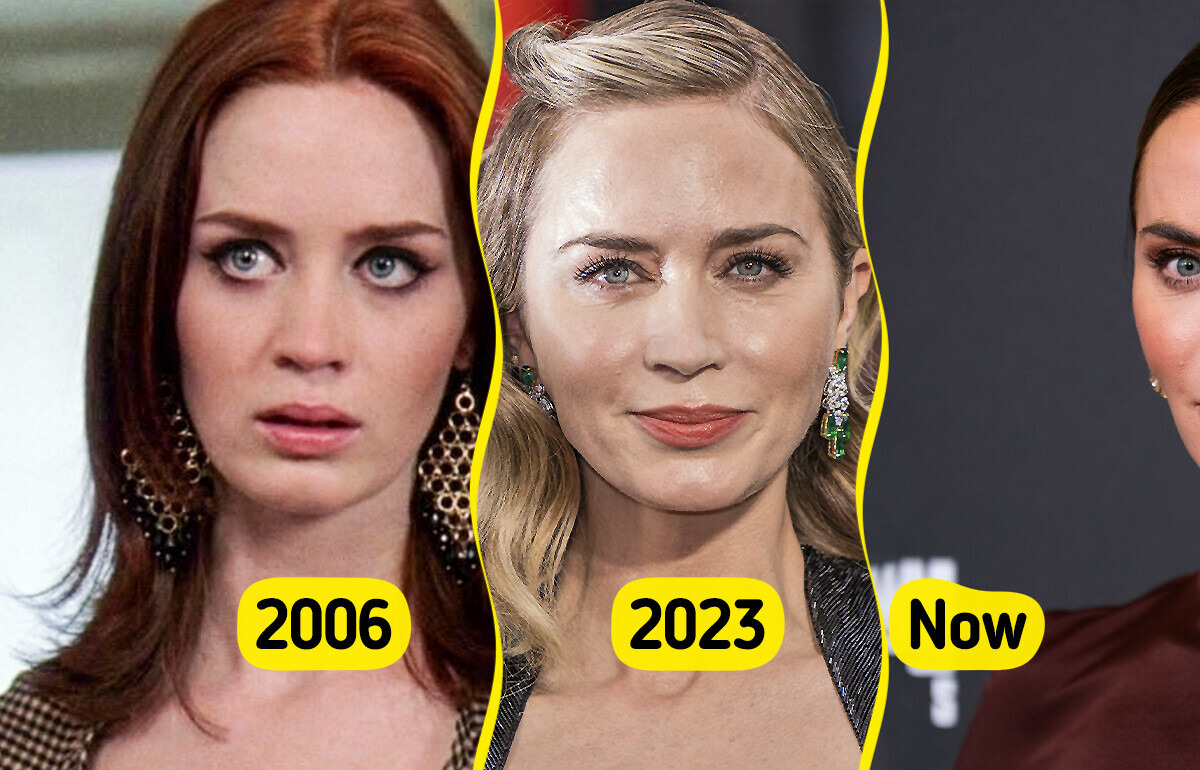“So Much Surgery,” Emily Blunt’s New Appearance Sparks Heated Controversy