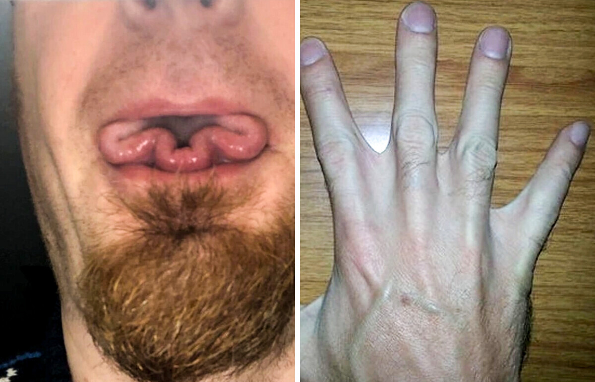 14 Unusual Features of the Human Body That Definitely Make Their Owners Stand Out From the Crowd