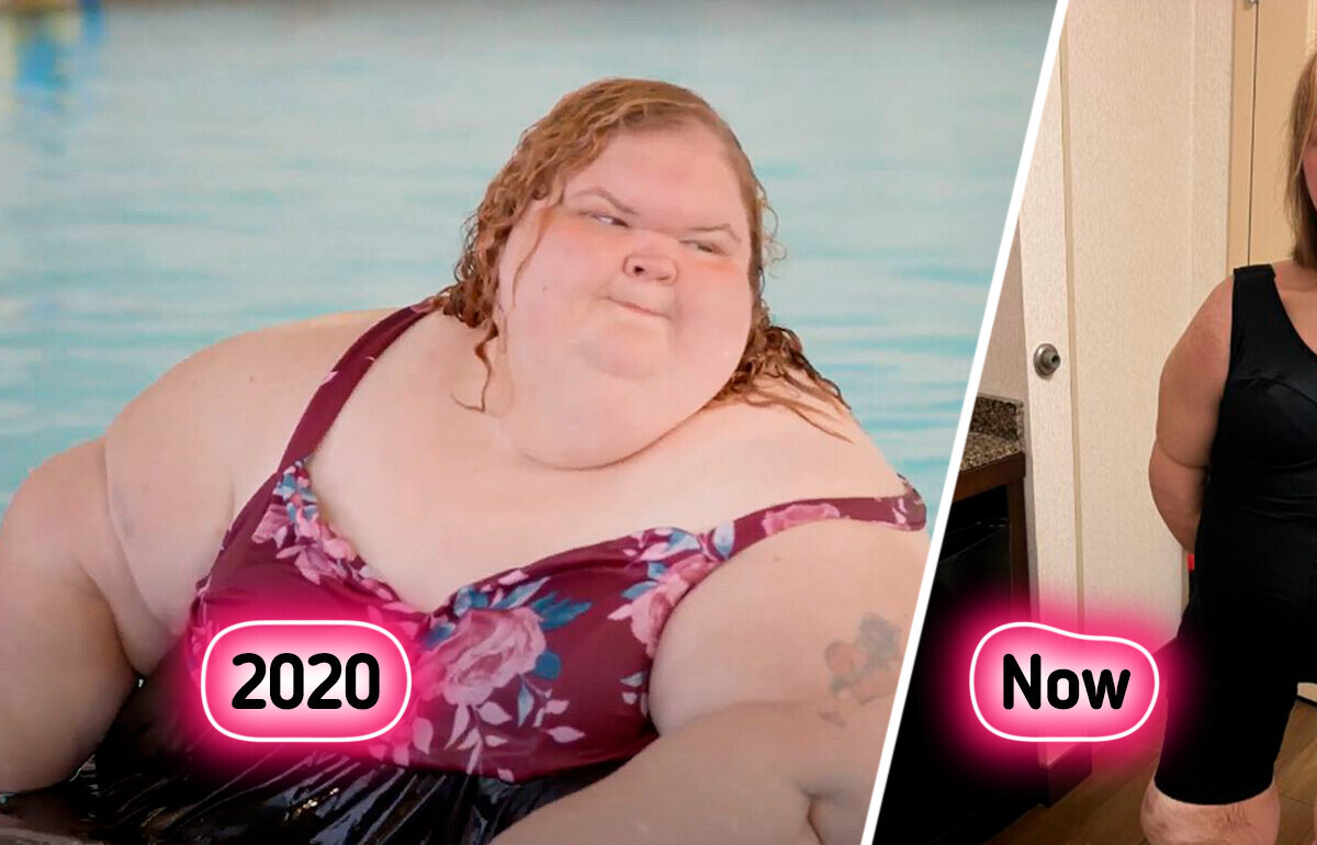 “1000-lb Sisters” Star Rocks Swimsuit After Skin Removal Surgery, Showing Off Her New Body “1000-lb Sisters” Star Rocks Swimsuit After Skin Removal Surgery, Showing Off Her New Body