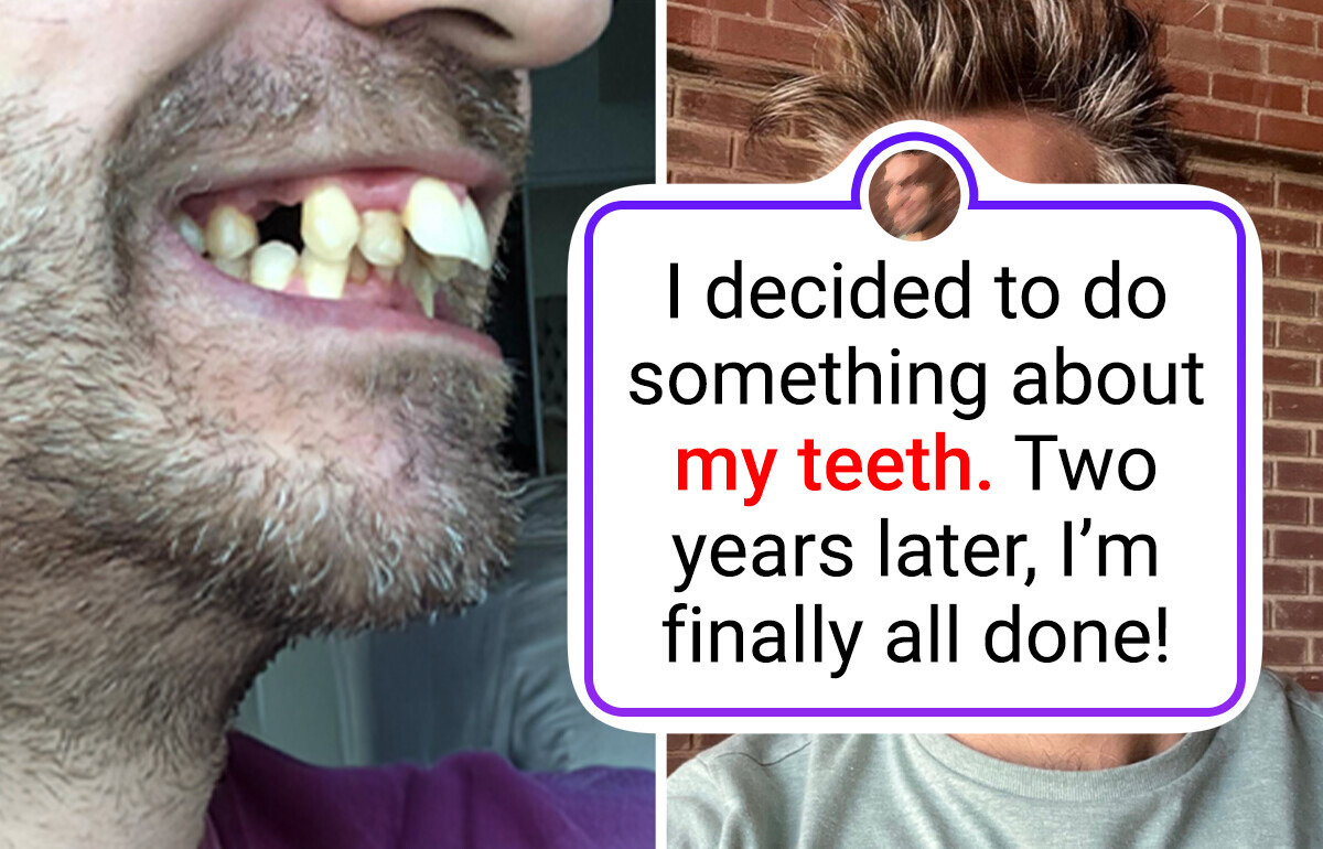 13 People Reveal Their Glow-Up Secrets — The Results Speak for Themselves 13 People Reveal Their Glow-Up Secrets — The Results Speak for Themselves