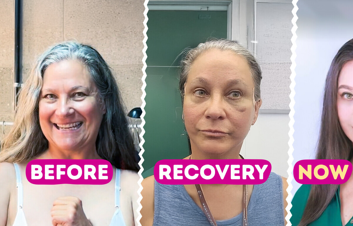 A Woman Won a Free “Mommy Makeover” in Korea — and the Results Left People Stunned