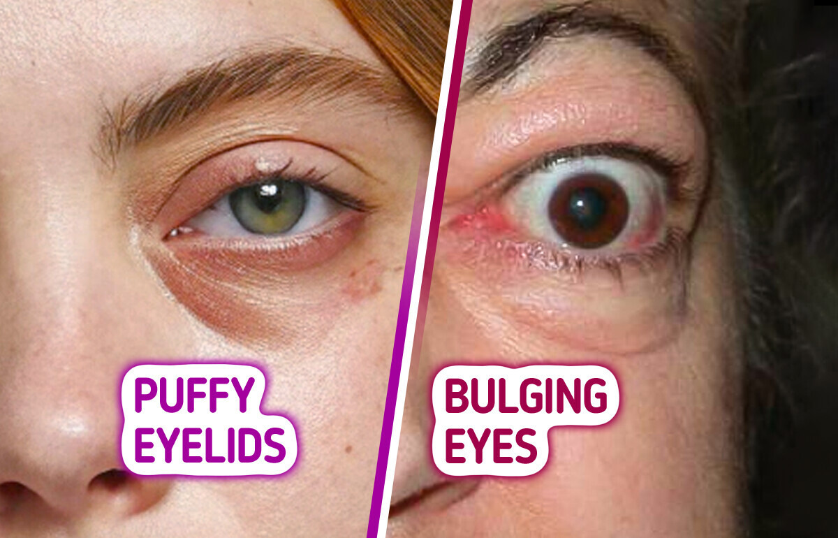 12 Uncommon Eye Changes That Could Reveal Hidden Health Problems