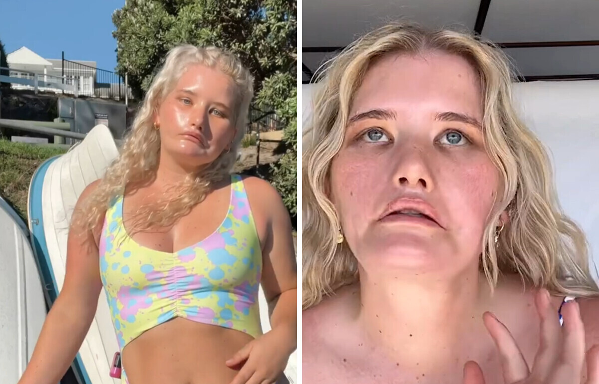 Model Who Can’t Smile Turned Her Unique Look Into Success — Proving That Beauty Has No Rules