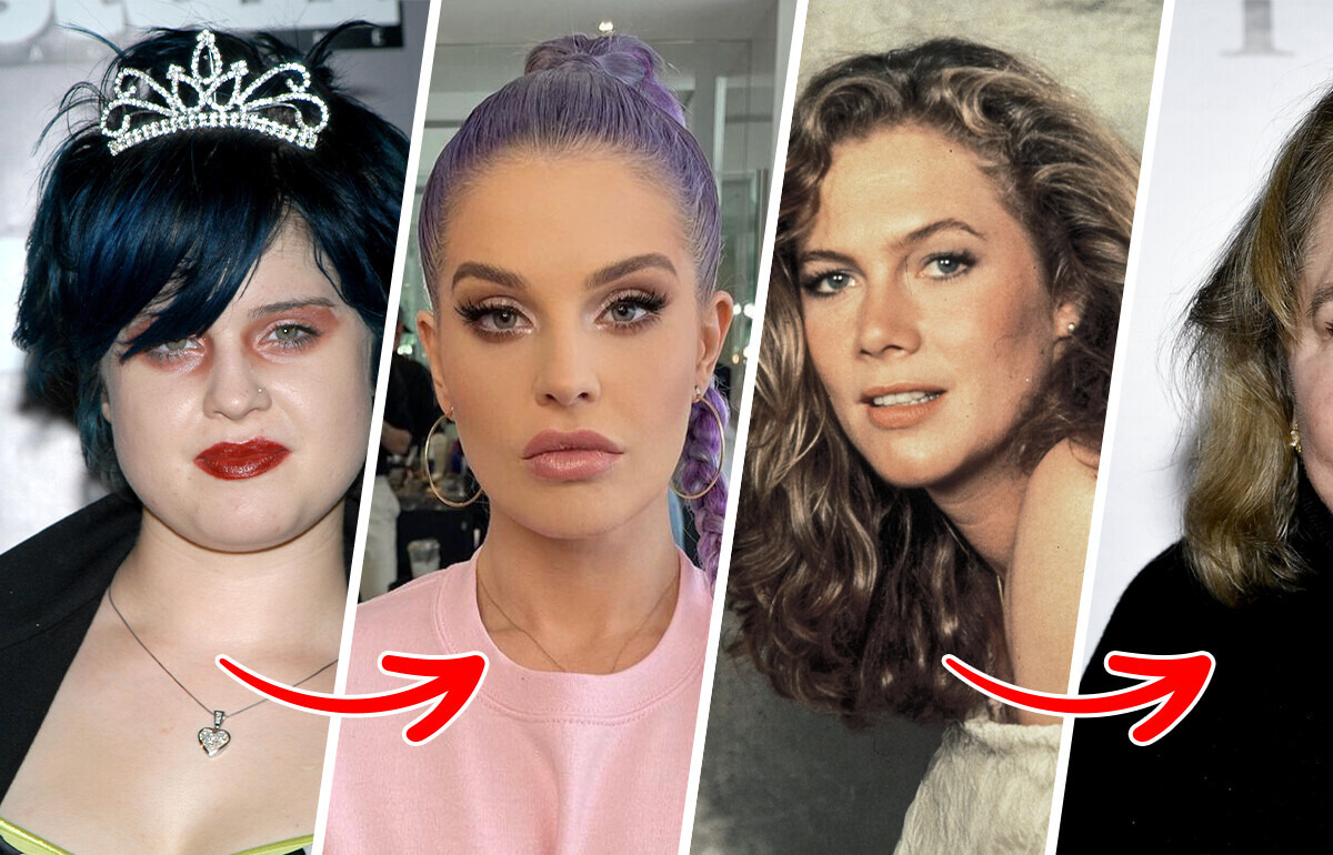 10 Celebrities Who Look Nothing Like They Used To