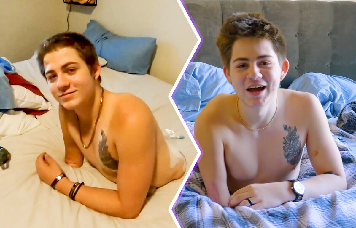 Teen Who Was Cut in Half by Forklift Defies Fate to Thrive and Uplift People