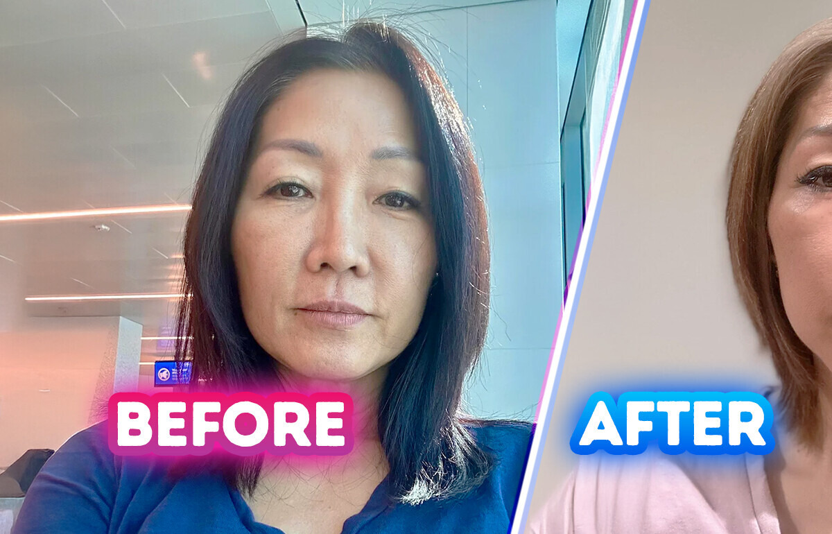 15 People Who Chose Plastic Surgery and Couldn’t Be Happier with Their New Looks