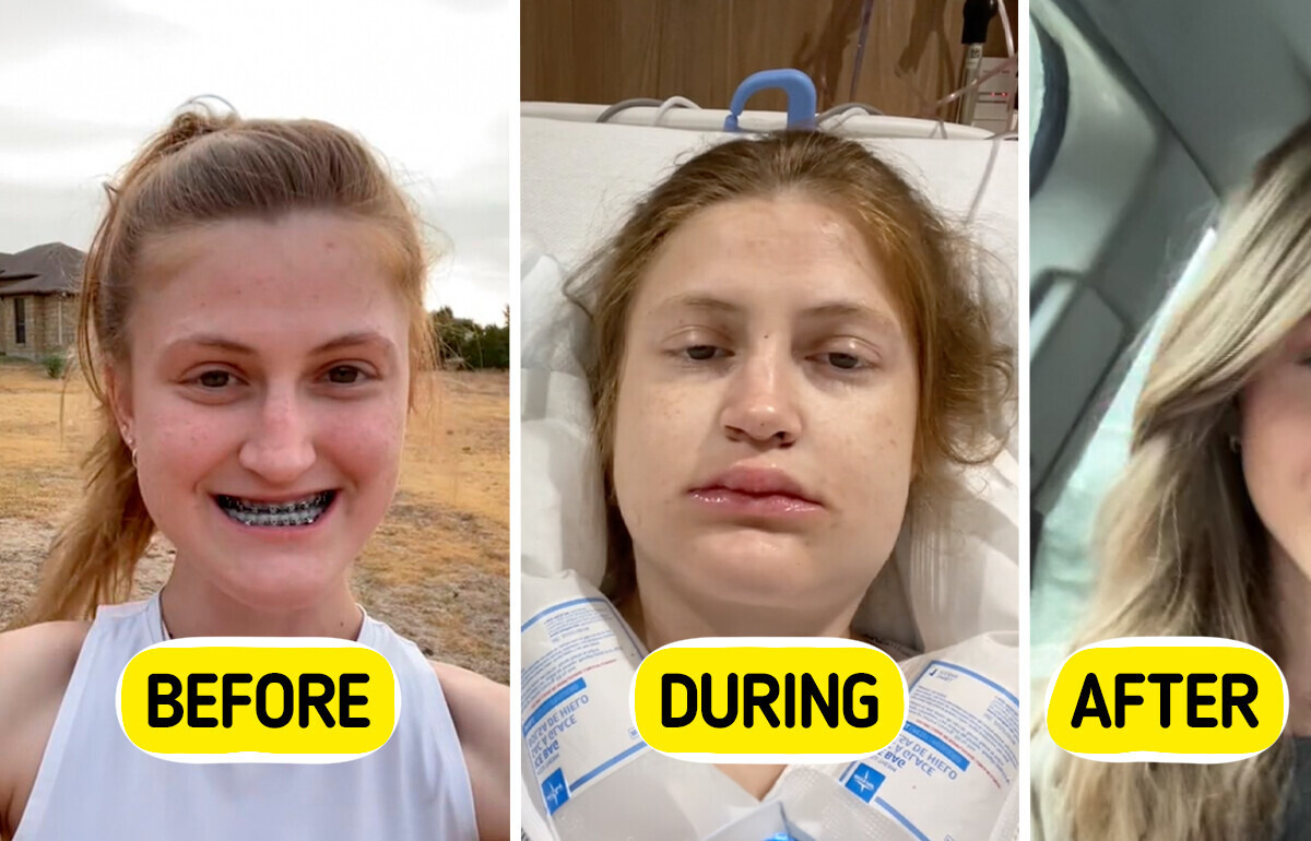 Her Double Jaw Surgery Left Everyone Speechless