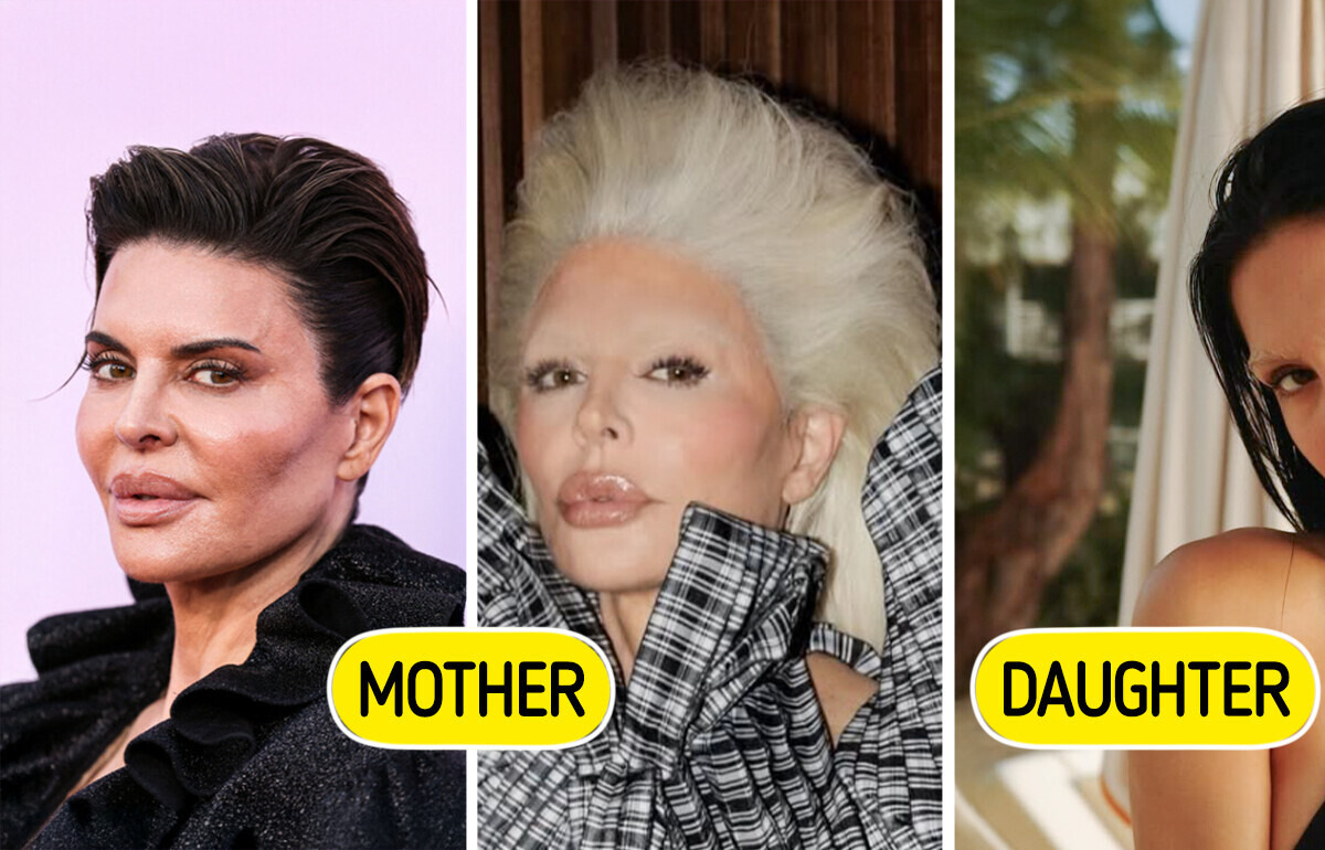 Lisa Rinna’s Daughter Revealed Plastic Surgery Procedures She’s Had, Some Details Are Truly Wild Lisa Rinna’s Daughter Revealed Plastic Surgery Procedures She’s Had, Some Details Are Truly Wild