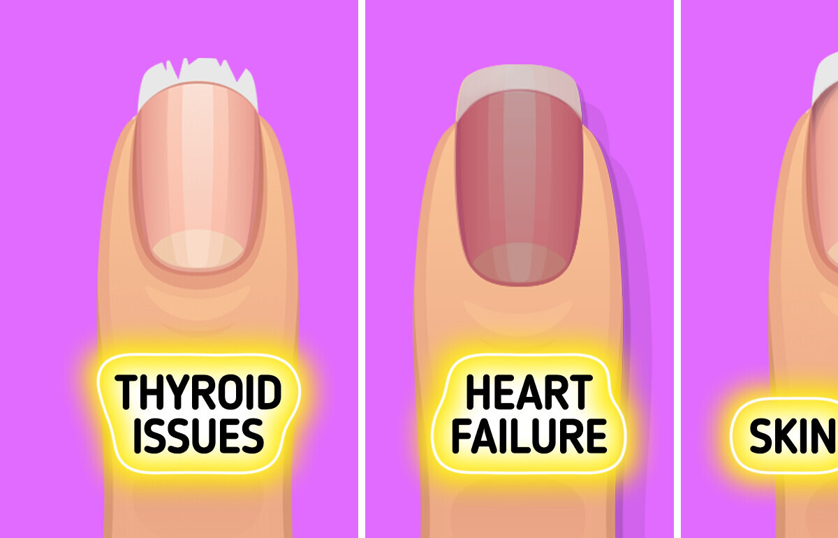 Your Nails Can Reveal Health Problems Before You Even Feel Sick Your Nails Can Reveal Health Problems Before You Even Feel Sick