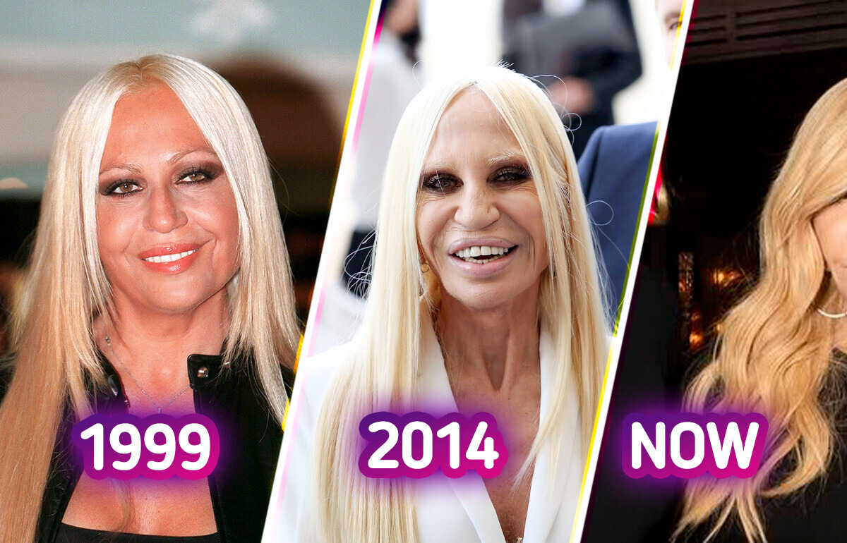 Donatella Versace Sparks Heated Buzz, Looks Unrecognizable in Latest Photos Donatella Versace Sparks Heated Buzz, Looks Unrecognizable in Latest Photos