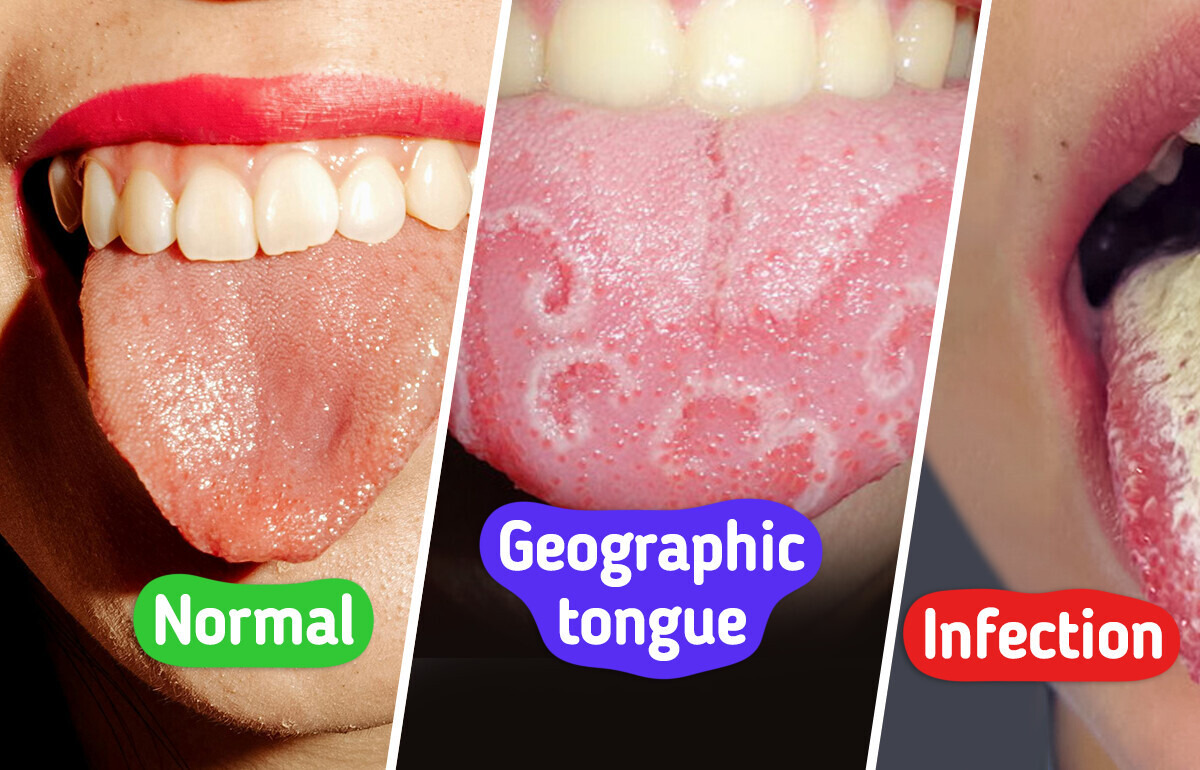 Your Tongue Can Alert You to Health Problems