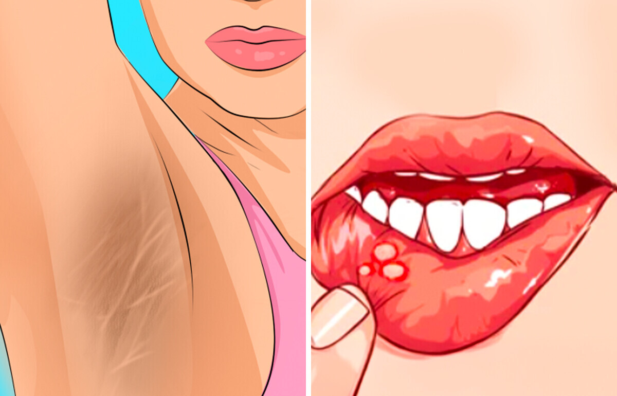 10+ Urgent Warnings Your Body Sends Before It’s Too Late