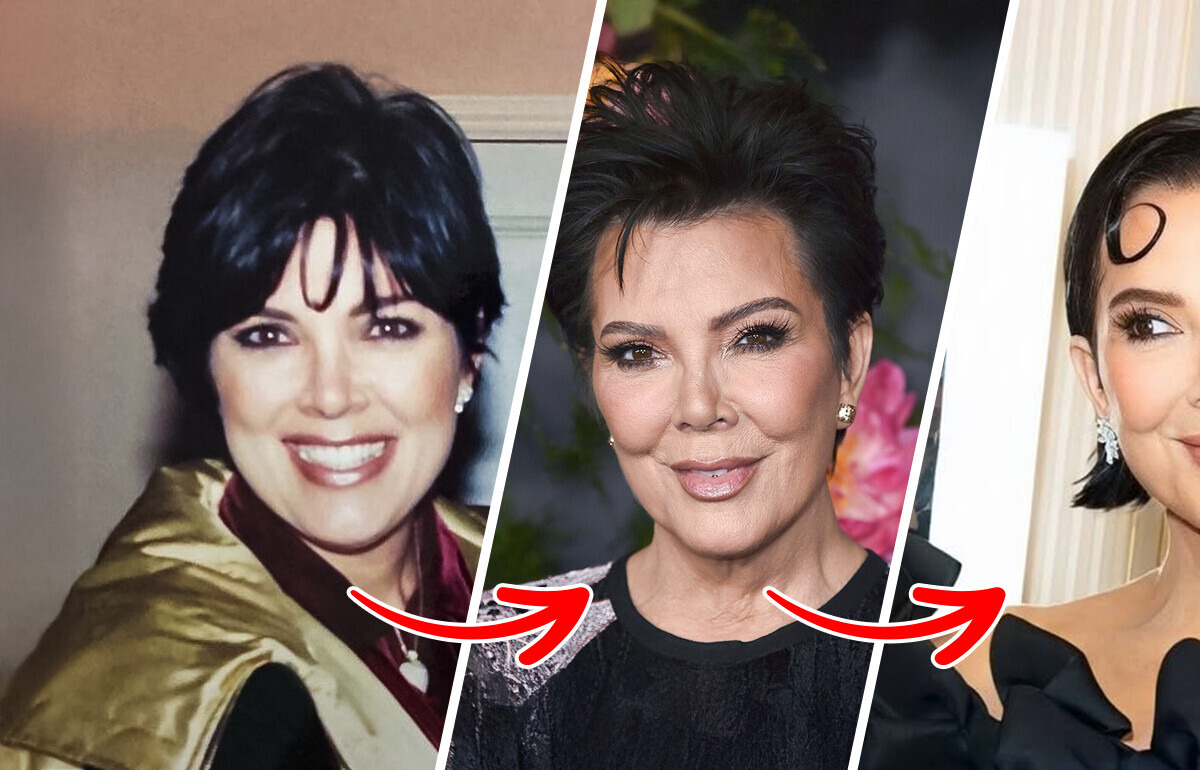 Kris Jenner Quietly Got a Facelift—Now Everyone’s Calling It the Best in Hollywood