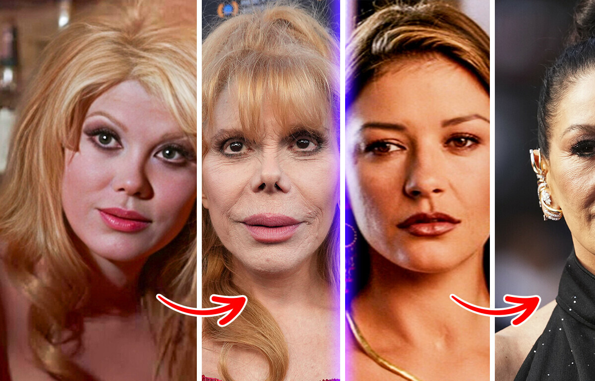 10 Celebrities Whose Dramatic Transformations Over Time Left Us Speechless