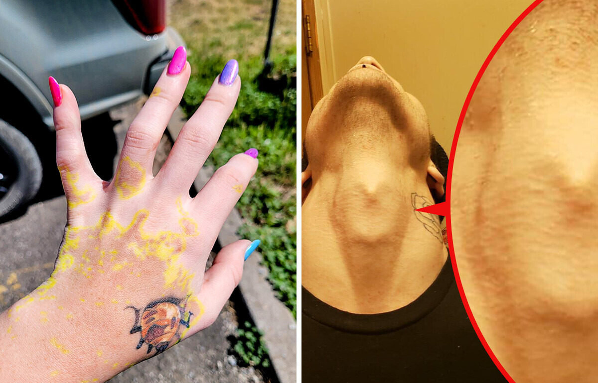 16 People With Unique Body Features You Don’t See Every Day