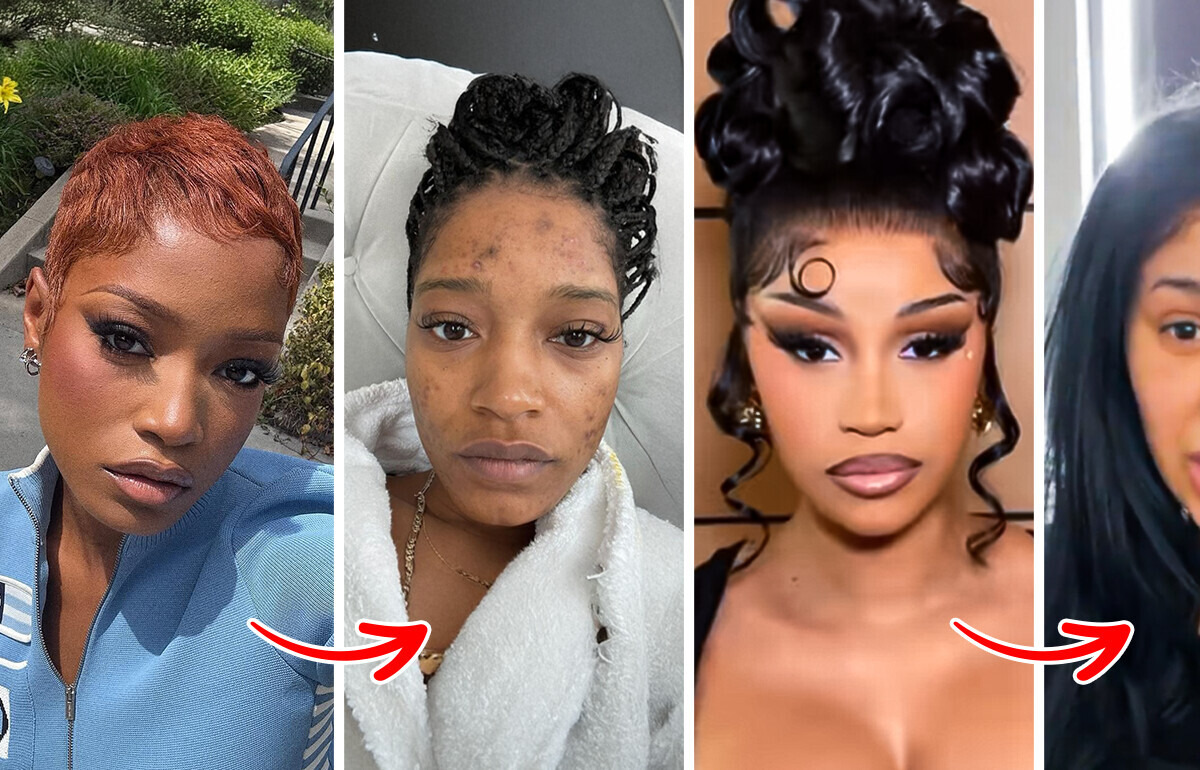 15+ Celebrities Who Bravely Showed Their Real Faces 15+ Celebrities Who Bravely Showed Their Real Faces