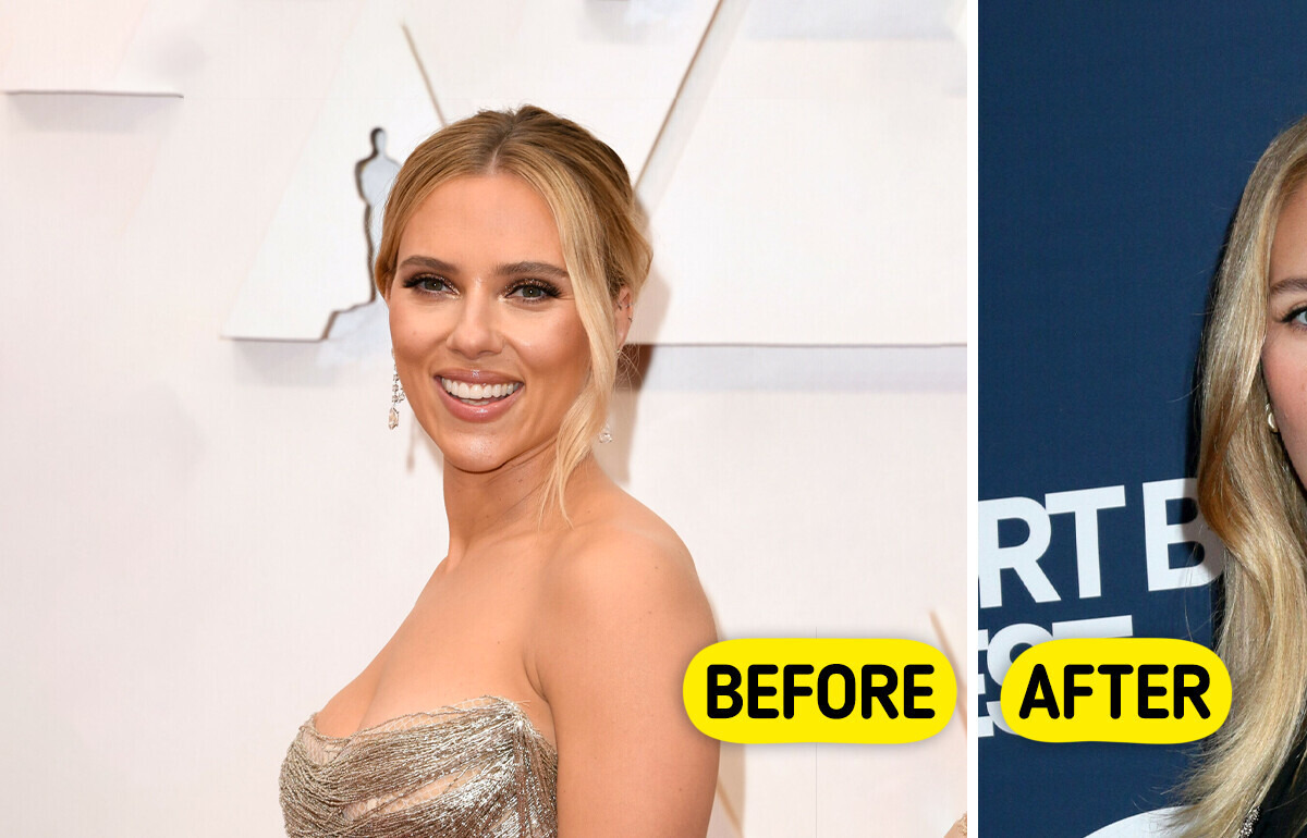 “Looks Like She Had Her Implants Removed,” Scarlett Johansson Debuts Her New Figure
