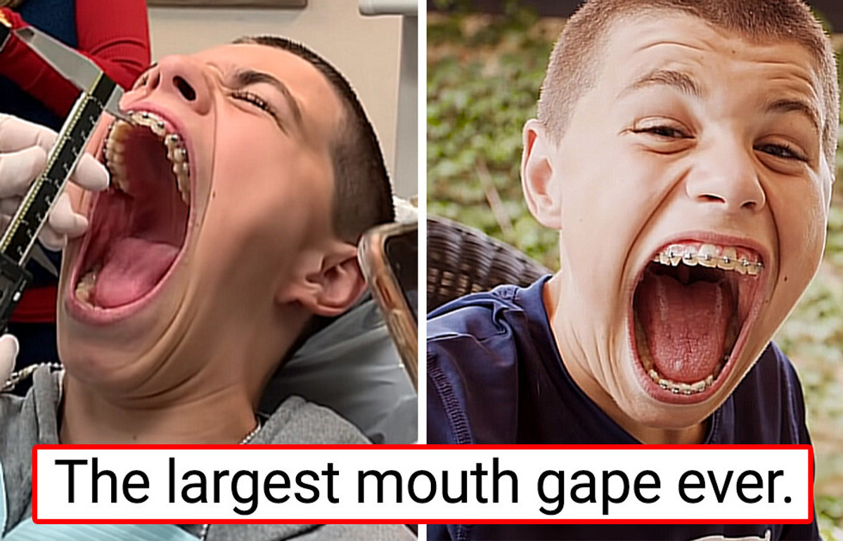 16 People With Unique Body Features You Don’t See Every Day