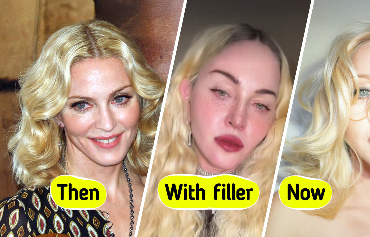 Madonna, 67, Debuts with a “NEW FACE”, Fans Are Speechless Madonna, 67, Debuts with a “NEW FACE”, Fans Are Speechless