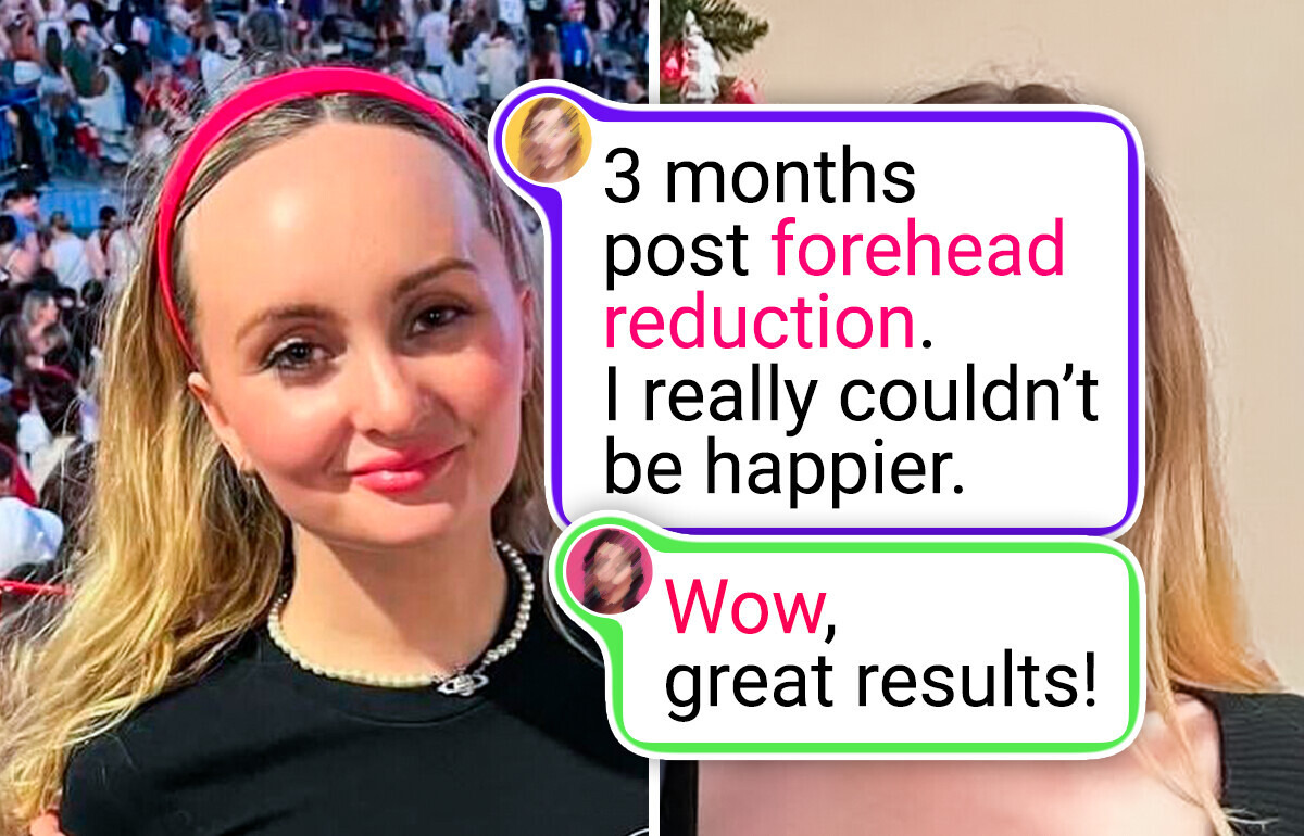 14 People Who Changed So Drastically, They’re Hardly Recognizable