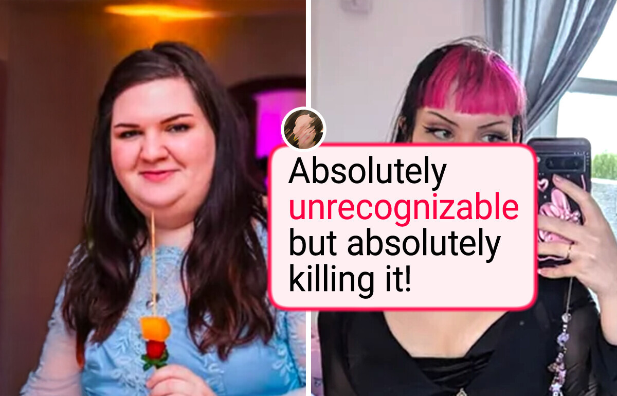 14 People Who Chose Plastic Surgery — and Were Absolutely Stunned by the Results