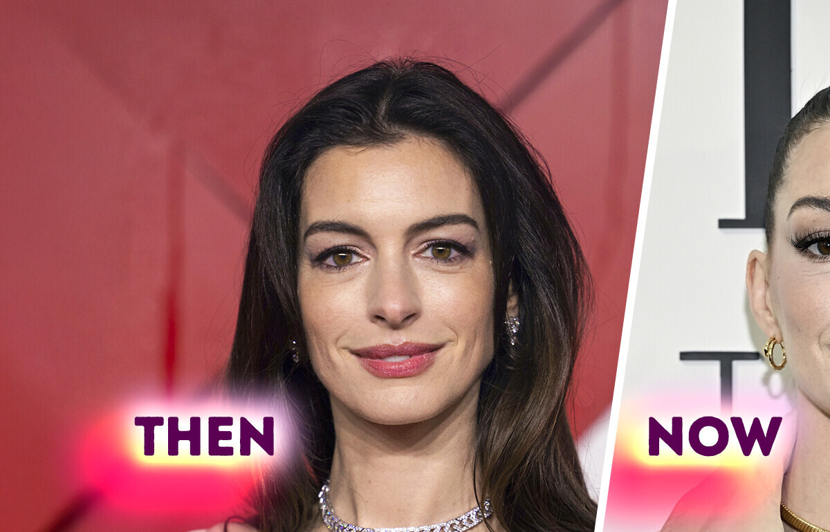 “Not Natural Anymore,” Anne Hathaway’s Youthful Appearance Sparked Plastic Surgery Rumors “Not Natural Anymore,” Anne Hathaway’s Youthful Appearance Sparked Plastic Surgery Rumors