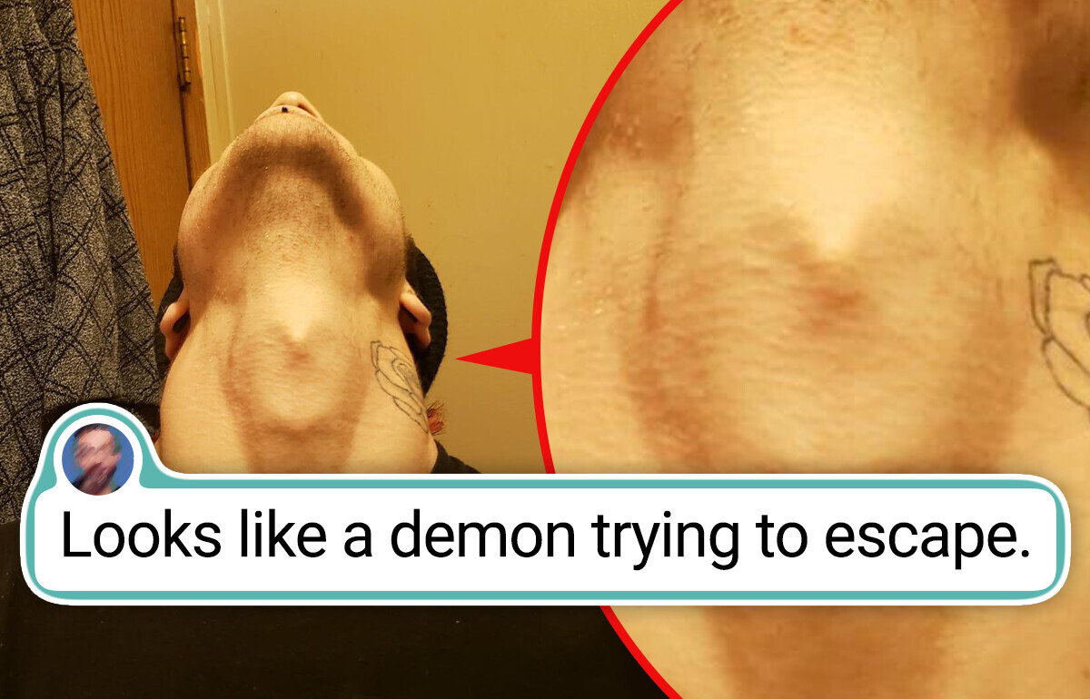 16 People With Unique Body Features You Don’t See Every Day