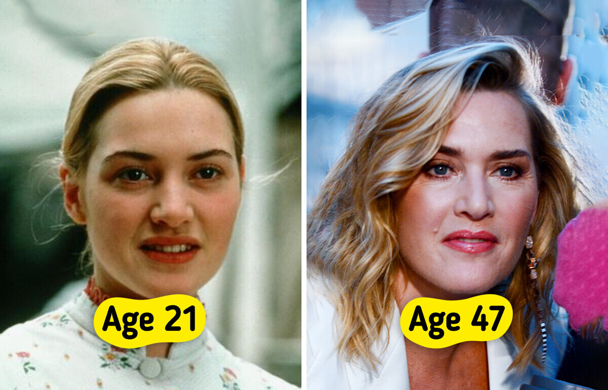 15 Celebrities Who Embrace Aging Gracefully — No Fillers Required 15 Celebrities Who Embrace Aging Gracefully — No Fillers Required