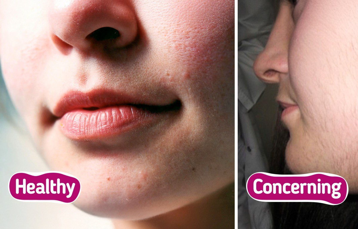 7 Alarming Signs Your Body Might Be Craving Vitamin D