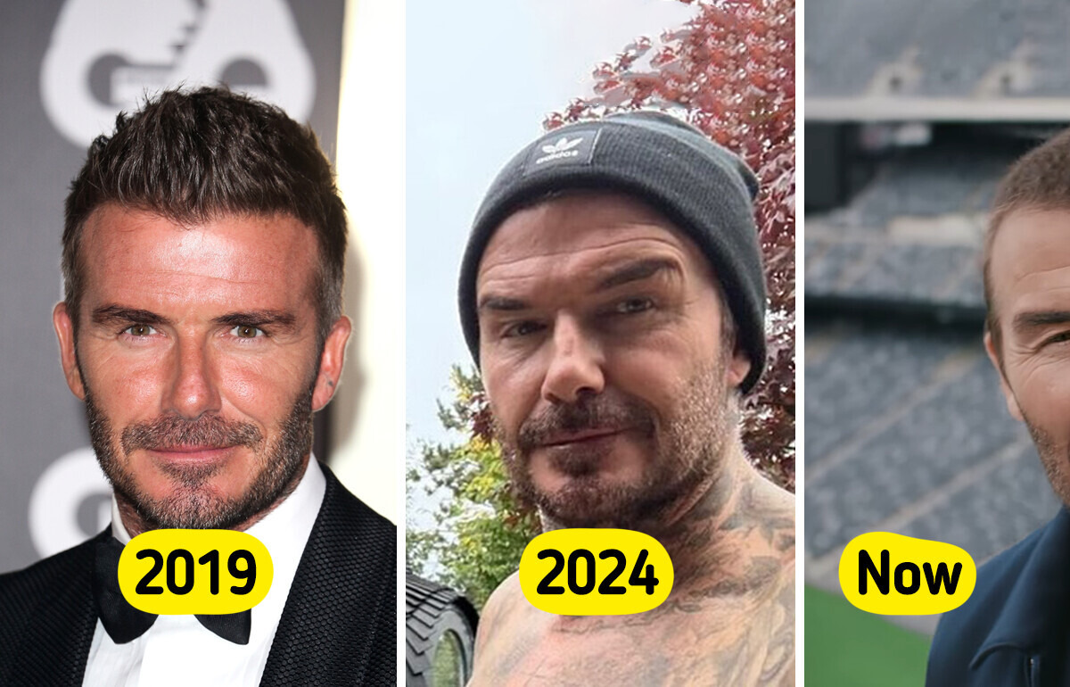 “Those Cheek Fillers Are Wild,” David Beckham’s New Face Sparks Heated Controversy