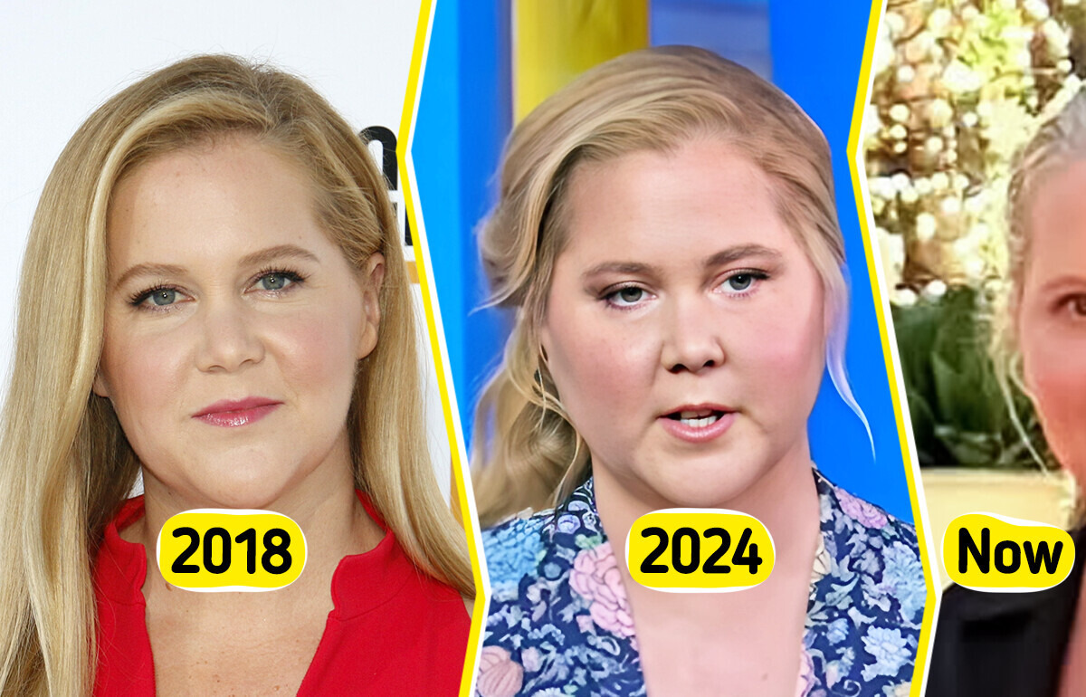 Amy Schumer’s New Look Sparks Buzz — People Can’t Stop Talking About Her Legs Amy Schumer’s New Look Sparks Buzz — People Can’t Stop Talking About Her Legs