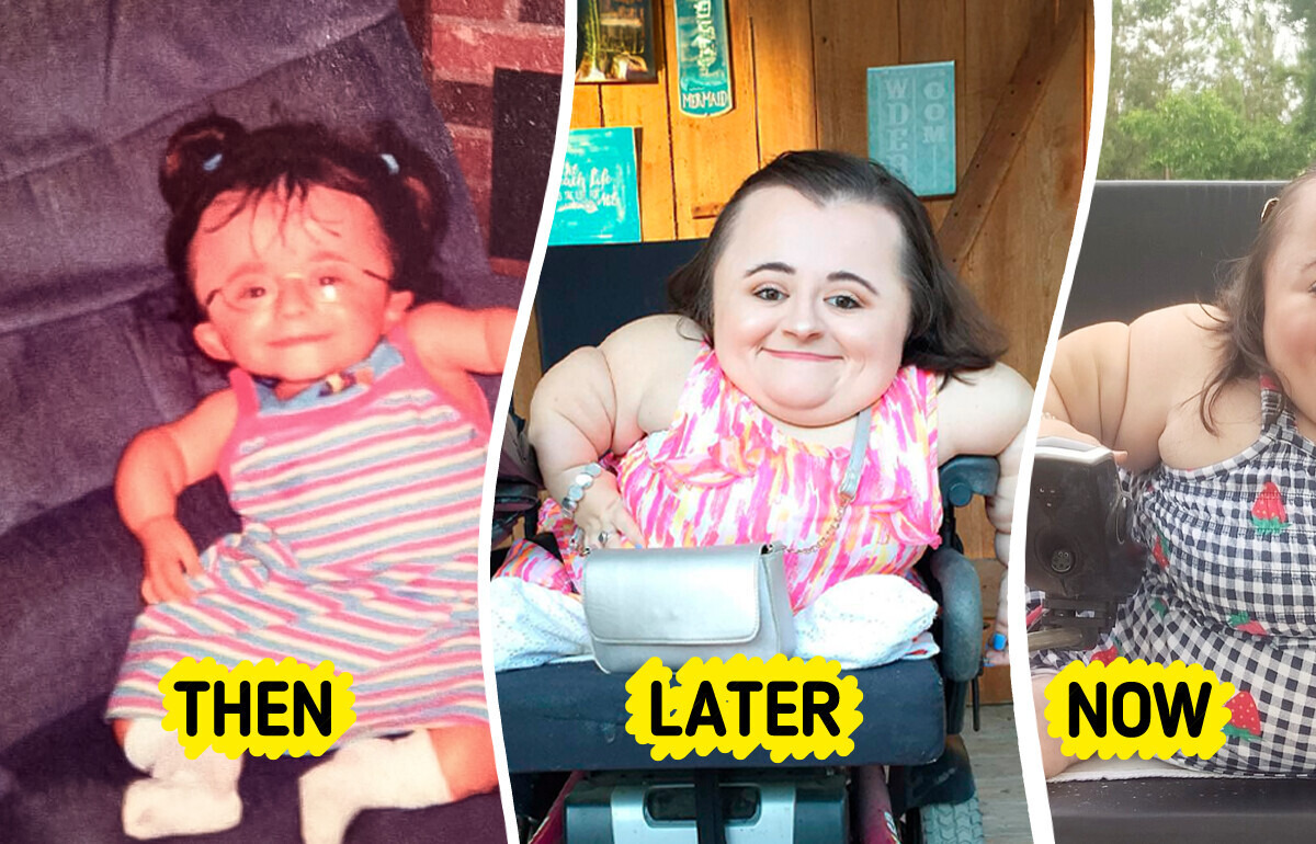 She Turned a Rare Disability Into a Powerful Beauty Empire She Turned a Rare Disability Into a Powerful Beauty Empire