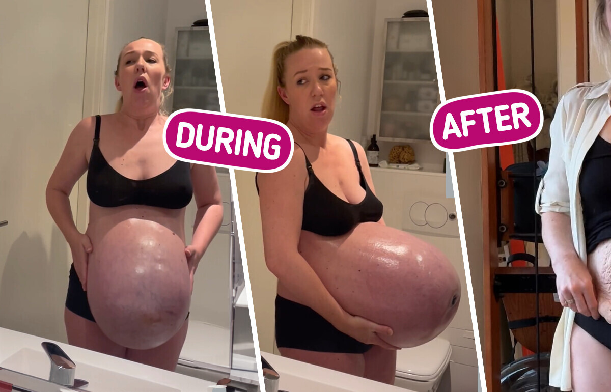 “That’s My Nightmare,” Mom’s Enormous Baby Bump That Sticks “Straight Out” Leaves People Speechless