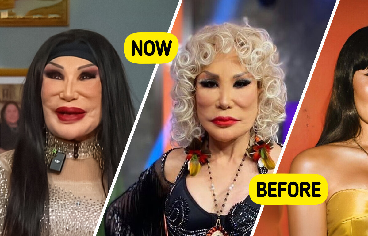 Jealousy Ruined This Mexican Star’s Face — See Her Incredible Comeback Jealousy Ruined This Mexican Star’s Face — See Her Incredible Comeback