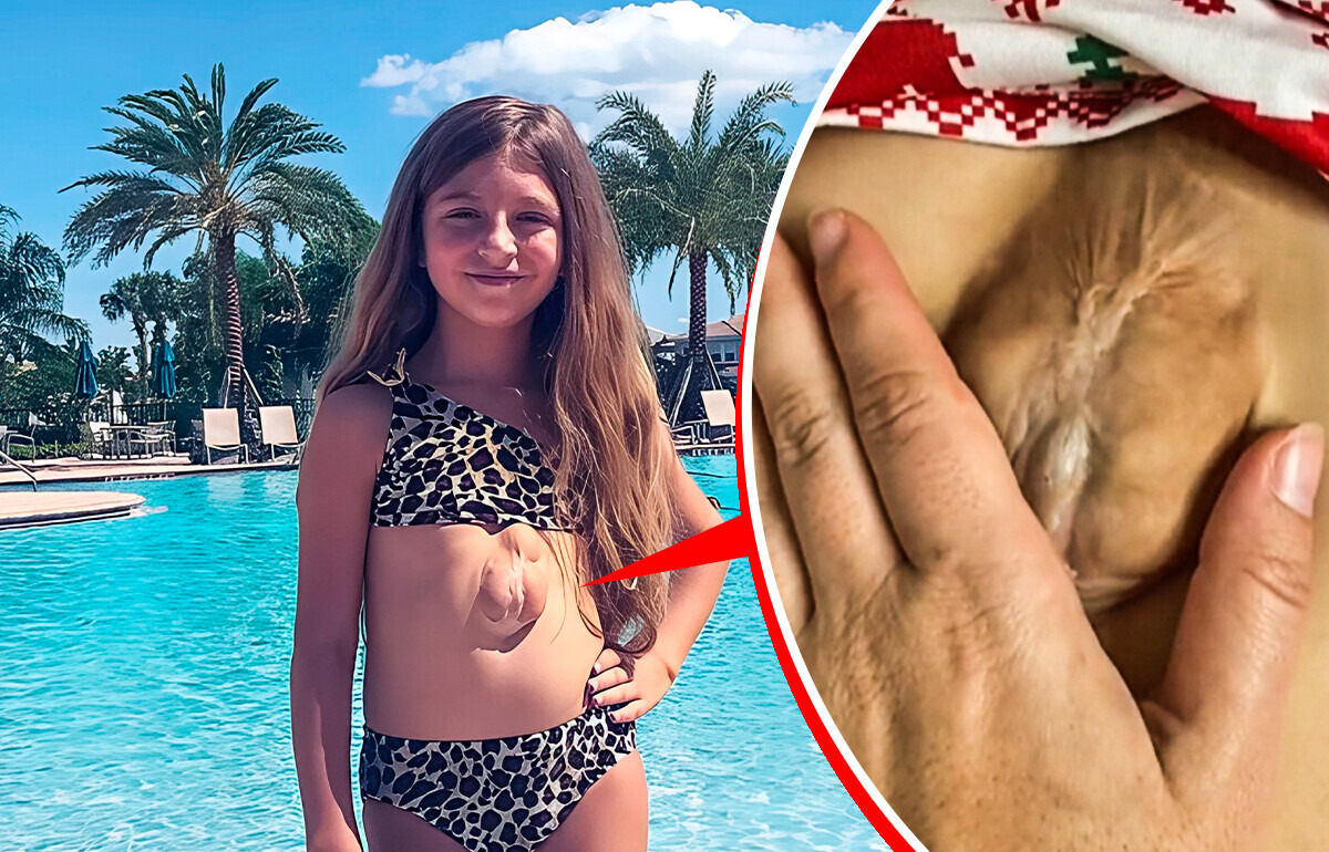 Meet a Girl Who Was Born With Her Heart Outside Her Chest, Defying Doctors Who Gave Her No Chance to Live Meet a Girl Who Was Born With Her Heart Outside Her Chest, Defying Doctors Who Gave Her No Chance to Live