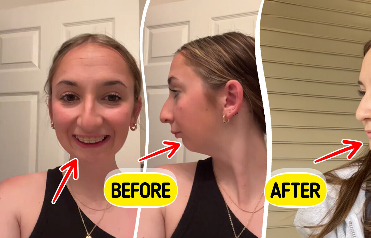 “SO CUTE!” People Are in Awe After This Woman’s Multi-Hour Jaw Transformation “SO CUTE!” People Are in Awe After This Woman’s Multi-Hour Jaw Transformation