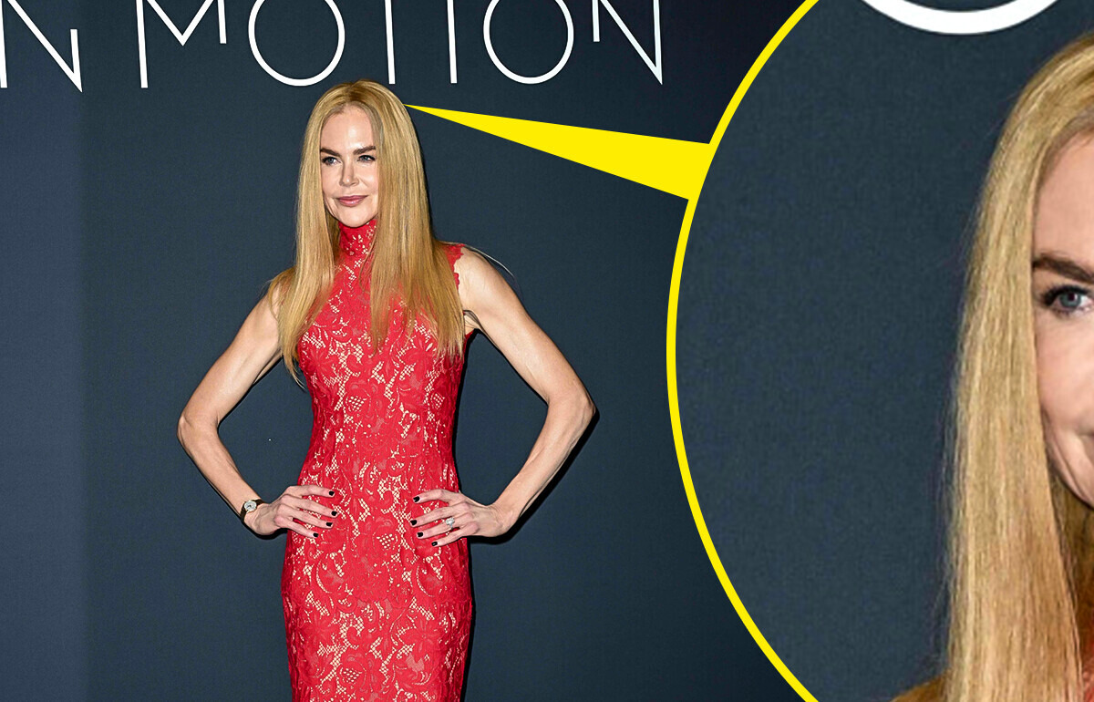 “She’s Going Bald...” One Small Detail in Nicole Kidman’s Look Is Causing Big Drama
