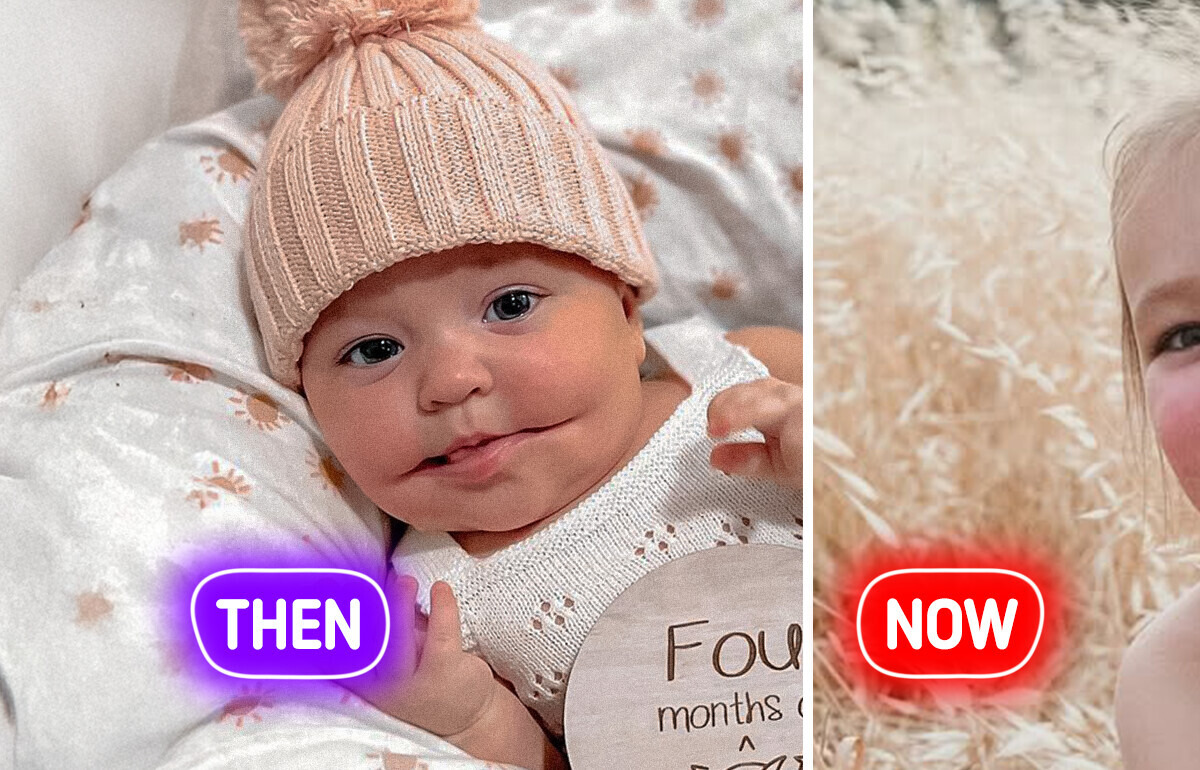 Baby Girl With a Rare Smile Grew Up — What She Looks Like Today Will Leave You Speechless