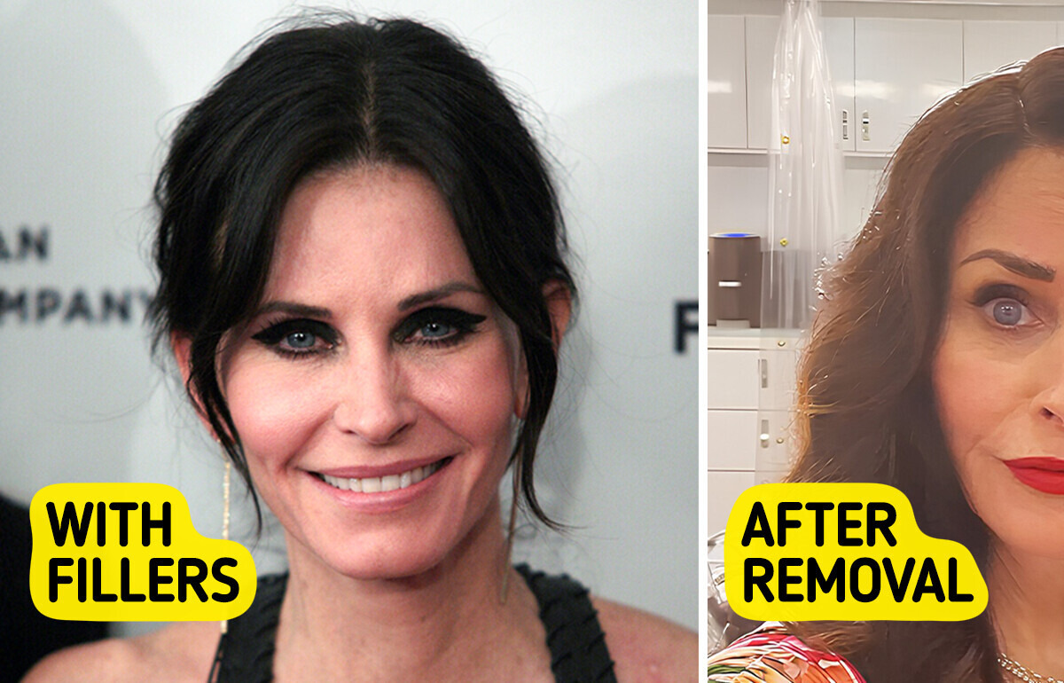 Courteney Cox Reveals She Dissolved Her Fillers After Regretting Them