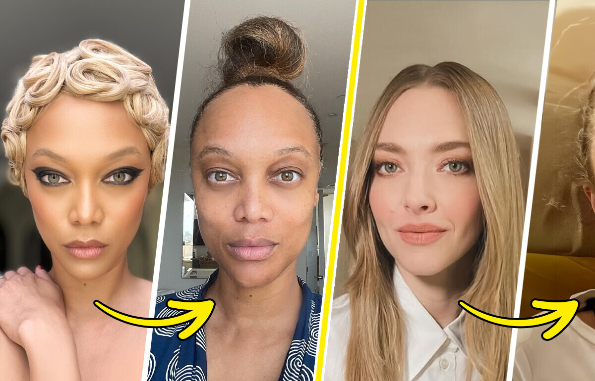 15 Stars Who Went Unfiltered to Show They’re Human Too