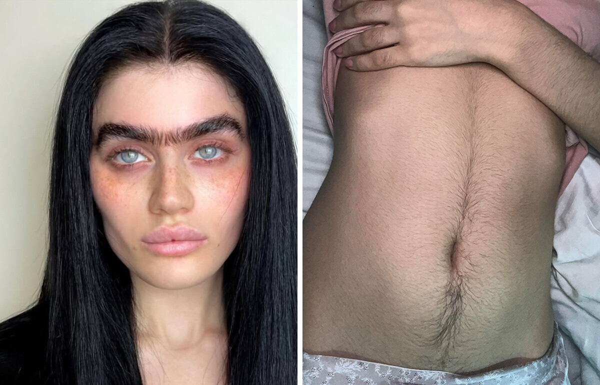 These 15 Women Show That Body Hair Is Nothing to Hide