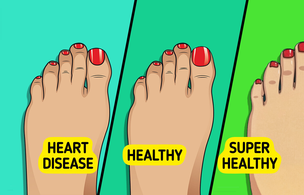 Your Toenails Might Be Telling You These Alarming Health Secrets