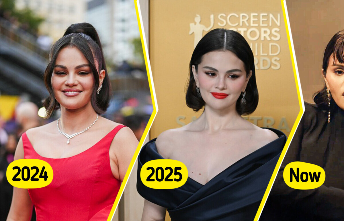 “What Happened to Her Face??” Selena Gomez’s New Look Confused Fans, Sparking Controversy